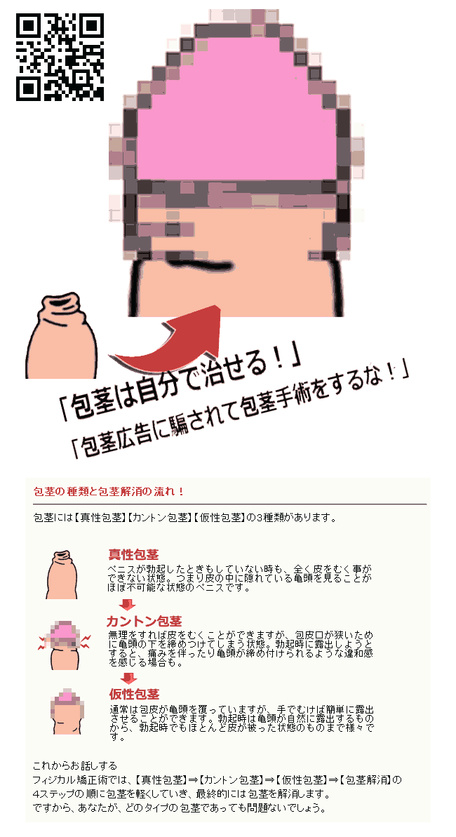 渡辺式のフィジカル包茎矯正術[本当の包茎矯正改善方法-渡辺式フィジカル包茎矯正術]→包茎(カントン包茎、真性包茎、仮性包茎)は手術、通院なしで矯正、治す事ができます。『渡辺式フィジカル包茎矯正術-病院では教えてくれない本当の包茎矯正改善方法-渡辺式フィジカル包茎矯正術』